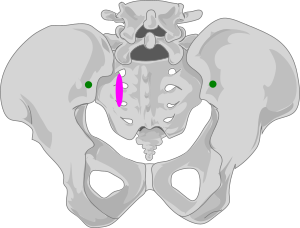 Antériorité droite du sacrum