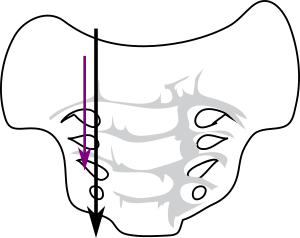 Axe vertical du sacrum